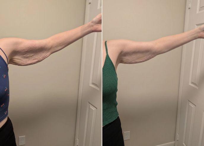 Patricia W., before / after 6 weeks