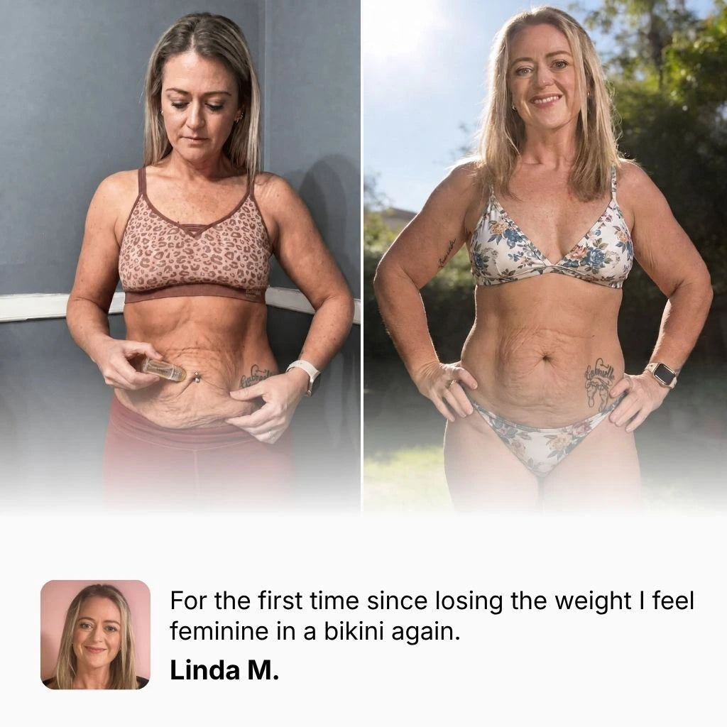Woman applying Vesper to abdomen