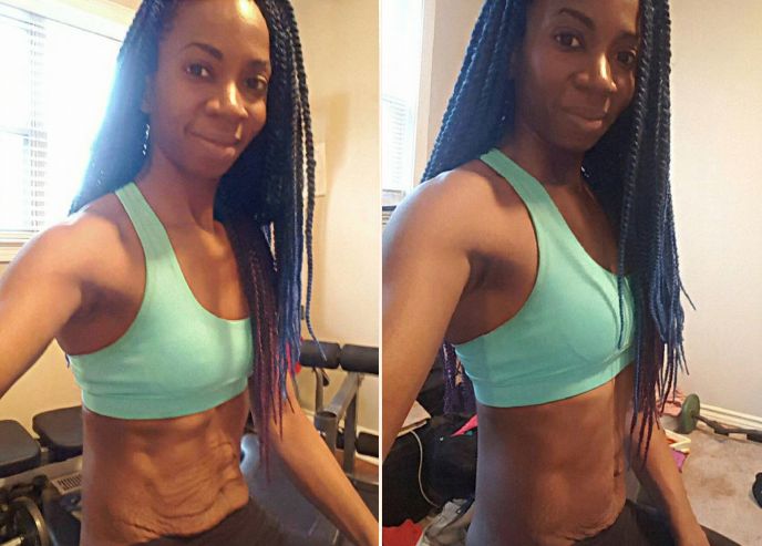 Before and after — Joanna P.