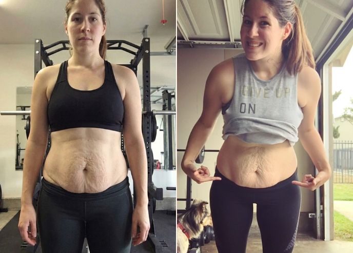 Before and after — Mira L.
